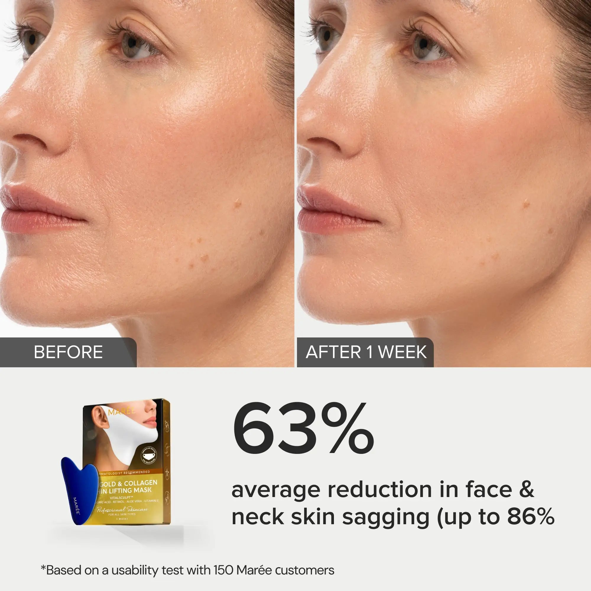 24K Gold V-Line Lifting Mask